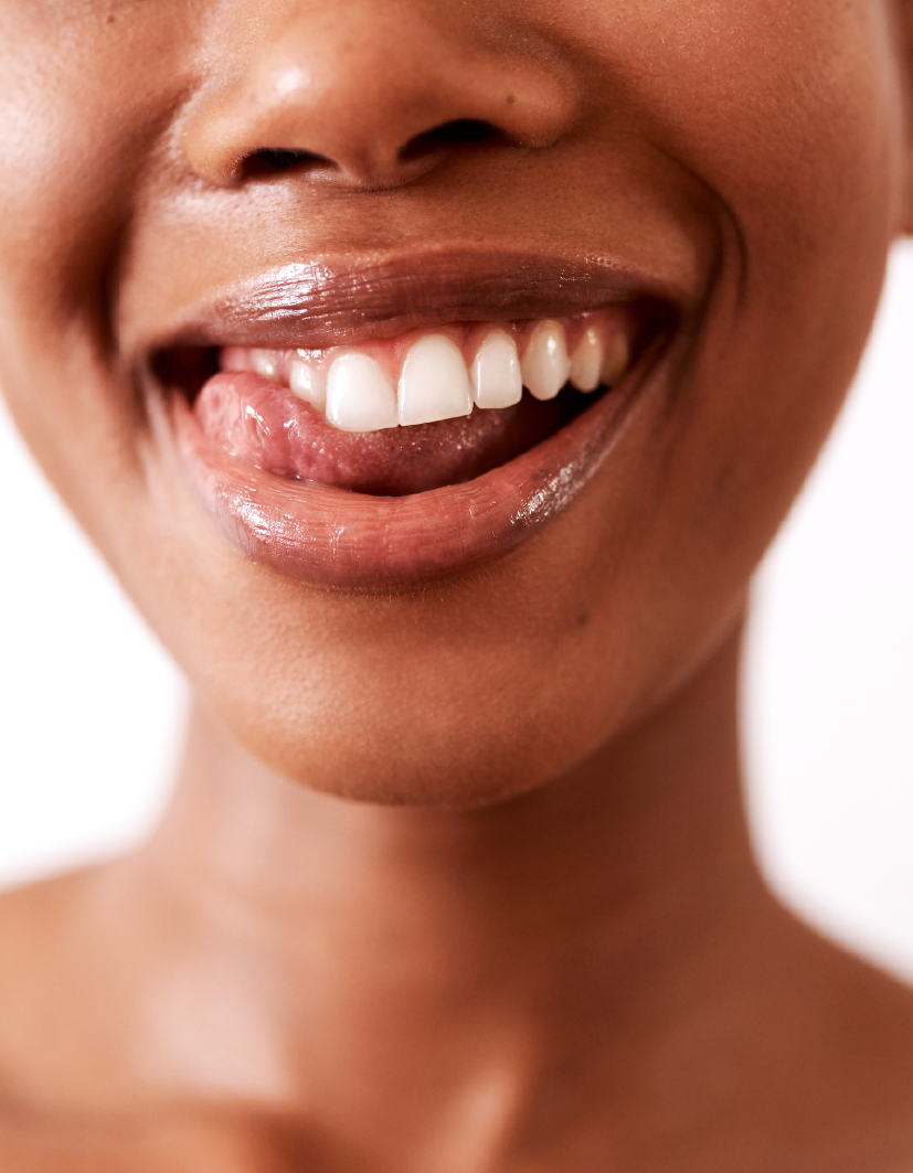 Soins Buccaux en marque blanche